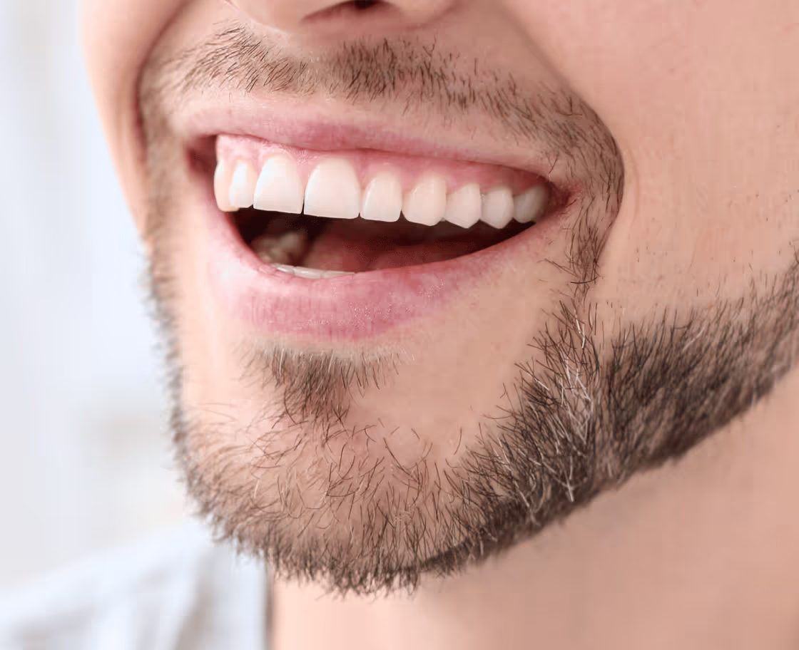 Expected Results & Benefits of Hollywood Smile Treatment
