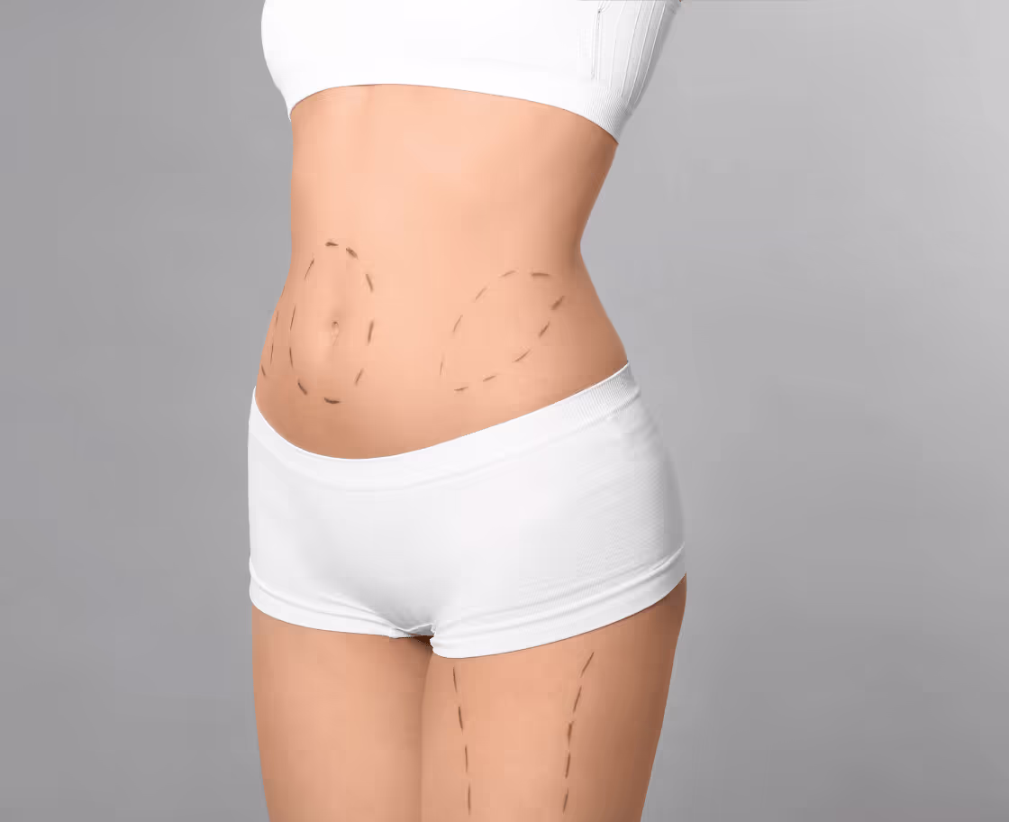 Expected Results & Benefits of Mommy Makeover