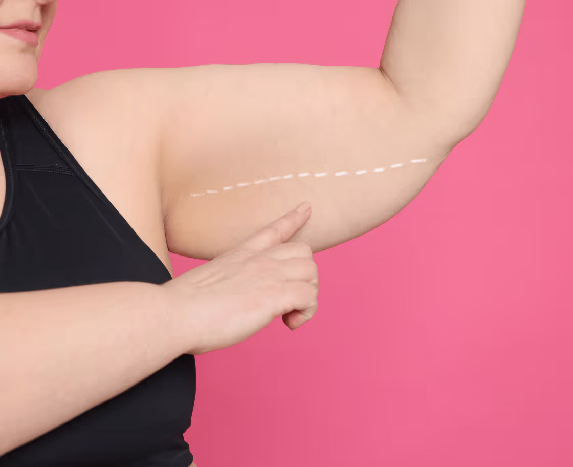 How does arm lift surgery work?