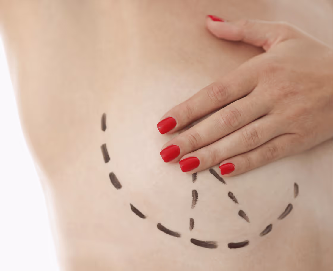 How Does Breast Augmentation Surgery Work?