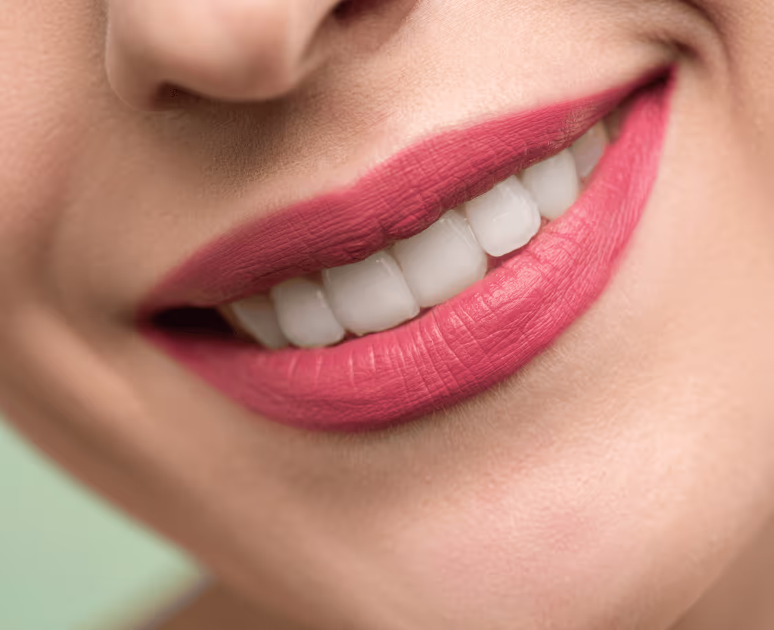 How Does Hollywood Smile Treatment Work?