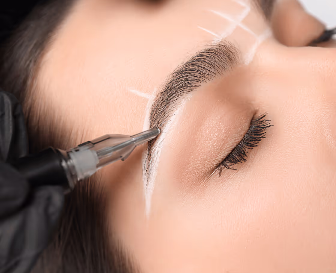What Is Eyebrow Transplant Surgery?