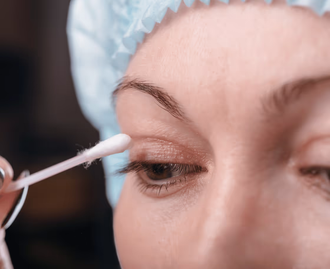 What is Eyelid (Blepharoplasty) surgery?