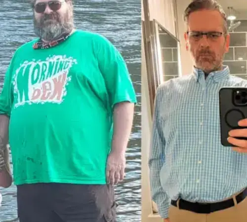 Türkiye'de yüz germe ameliyatı