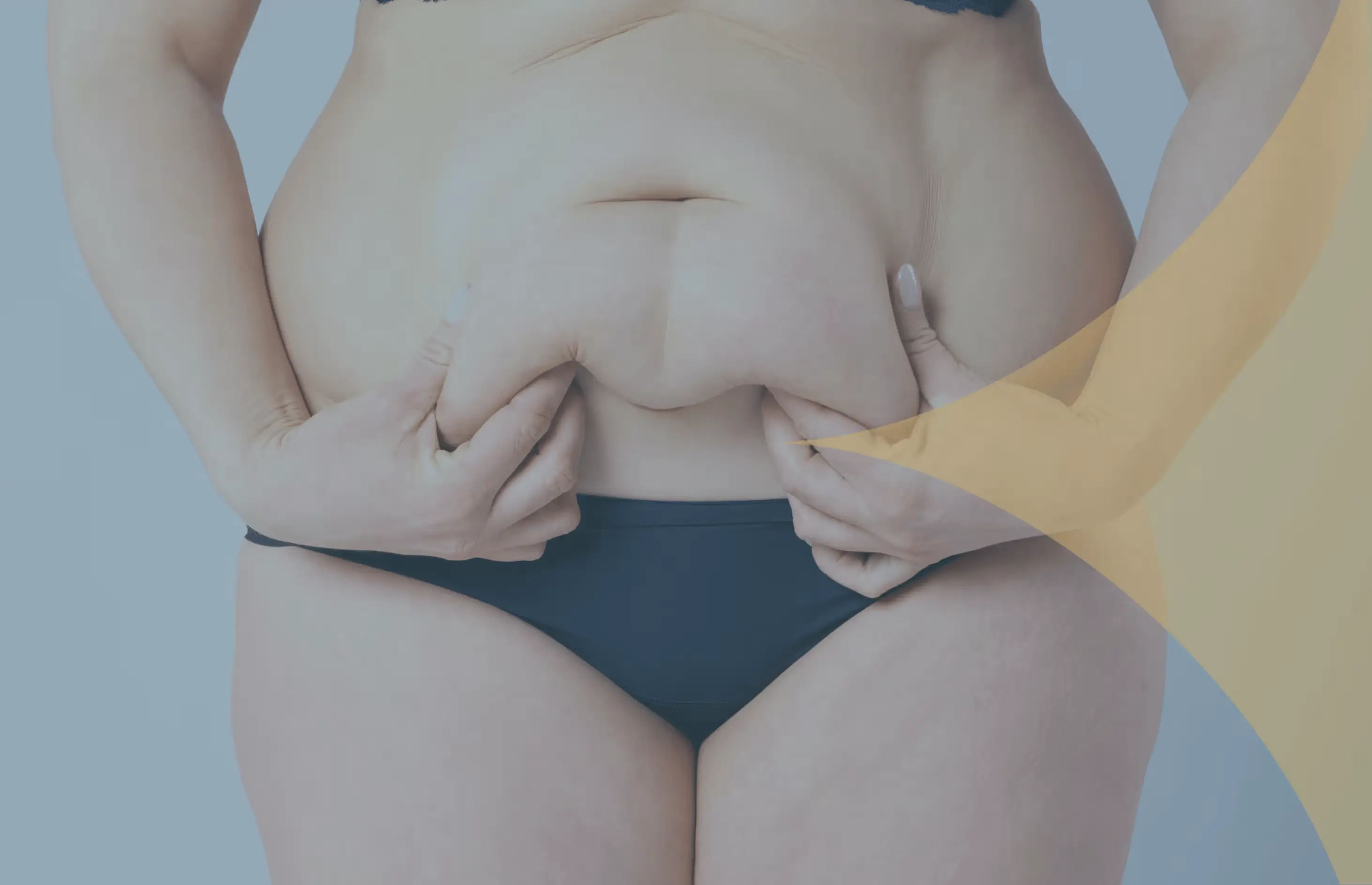 Mommy Makeover in Turkey