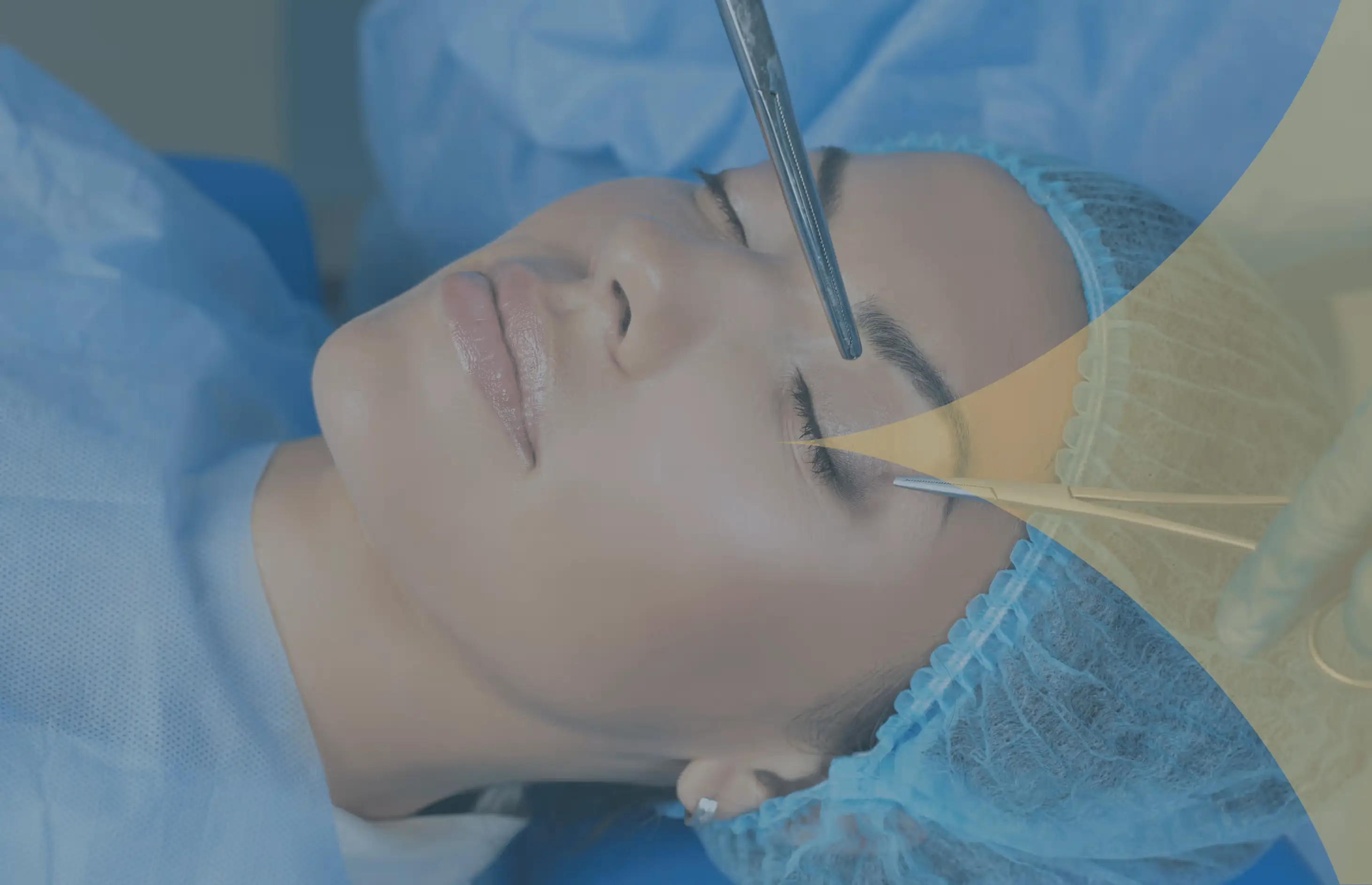 Eyelid Surgery (Blepharoplasty) in Turkey